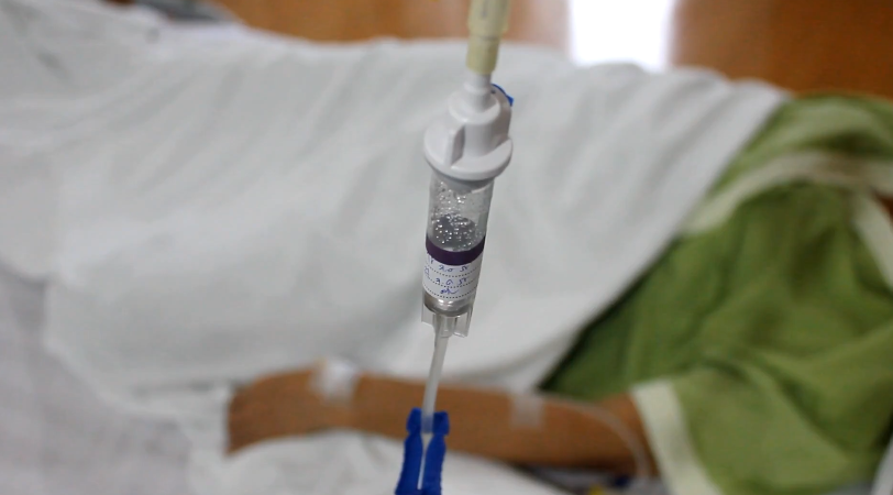 Perfusion Chimio